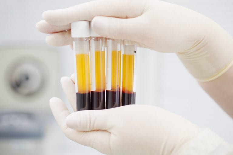Se retracta la FDA de EU sobre comentarios del uso de plasma sanguíneo para tratar al Covid-19