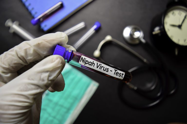 ¡Alerta en India! fallece un menor por el virus Nipah con potencial pandémico