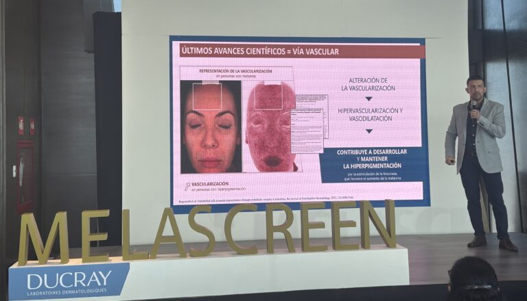Hiperpigmentación o Paño se controla: Dermatólogos