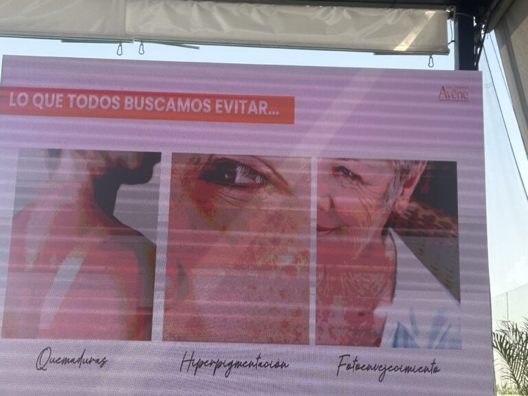 Exposición solar factor de riesgo de cáncer de piel