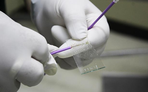 Detección oportuna de Virus del Papiloma Humano y cáncer cervicuoterino: IMSS