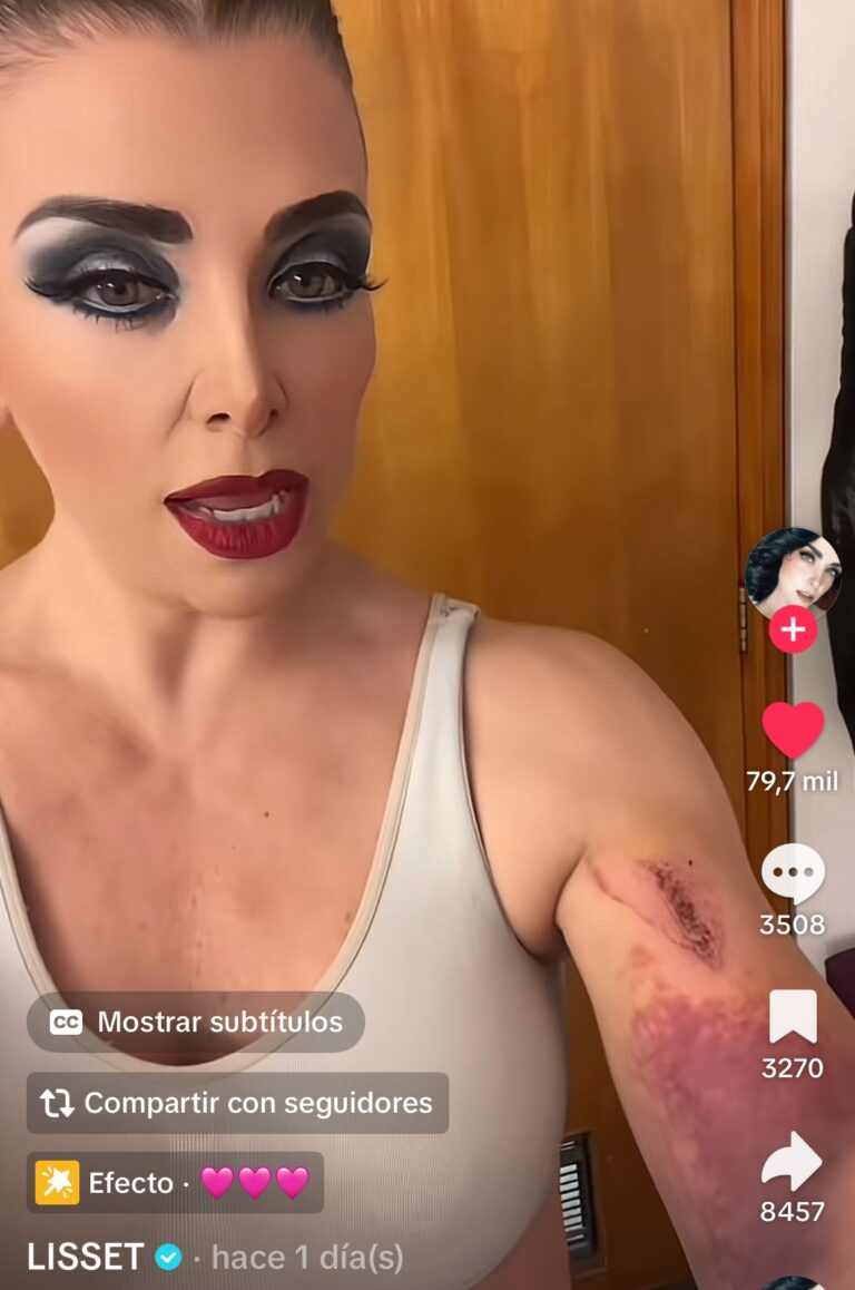 Lisset denuncia que las coladeras de la CDMX son una trampa mortal