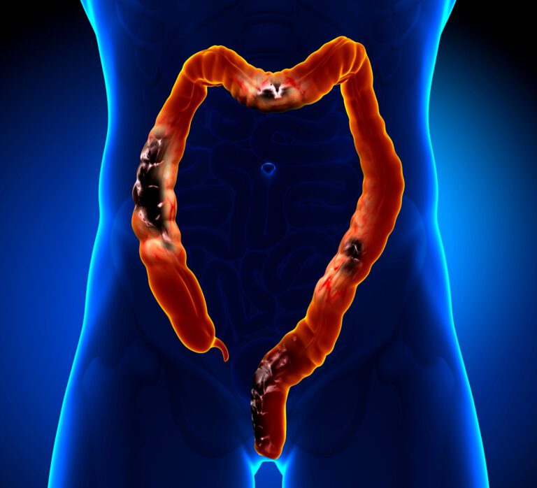 Cáncer digestivo: señales que no debes ignorar y que pueden marcar la diferencia