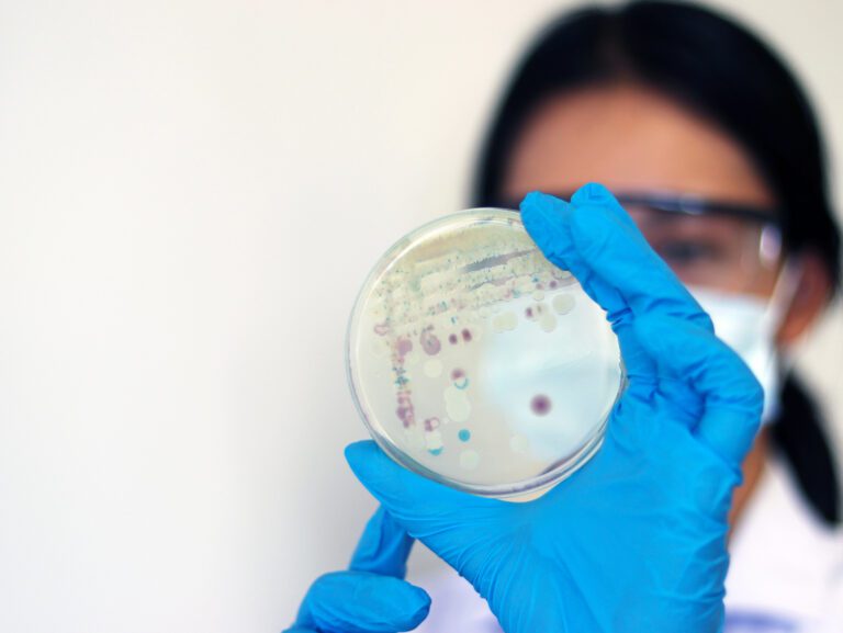 Bacteria “come carne” suma 10 muertes en Estados Unidos durante el 2026
